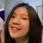 สาวจัดฟัน เอามีนส์ ๆ