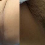 คนสวยโชว์หีหมอย