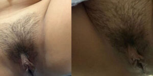 คนสวยโชว์หีหมอย